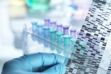 Scientist holding DNA gel in front of samples for testing in laboratory