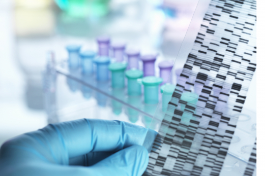 Scientist holding DNA gel in front of samples for testing in laboratory